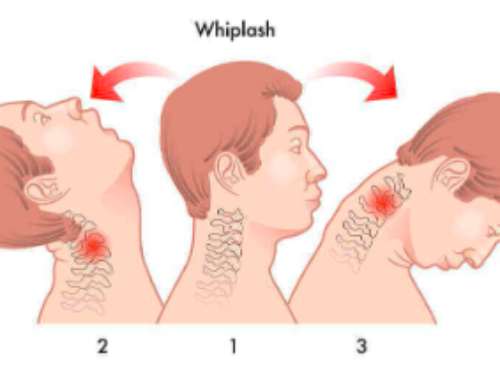 WHIPLASH ASSOCIATED DISORDER